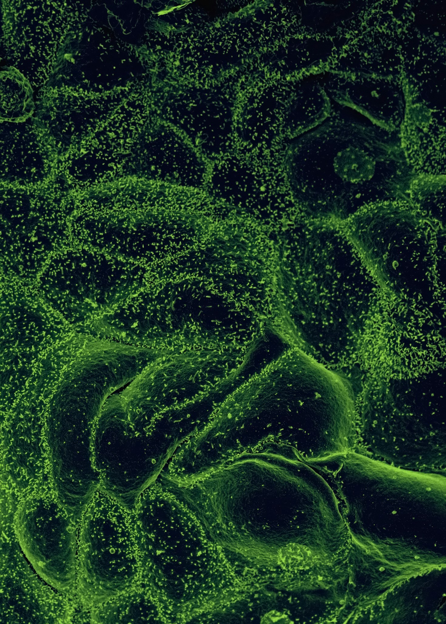 Waarom microalgen een duurzame oplossing bieden